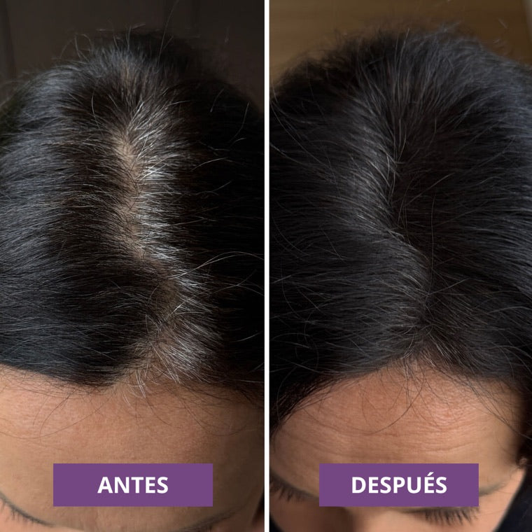 Antes y despues