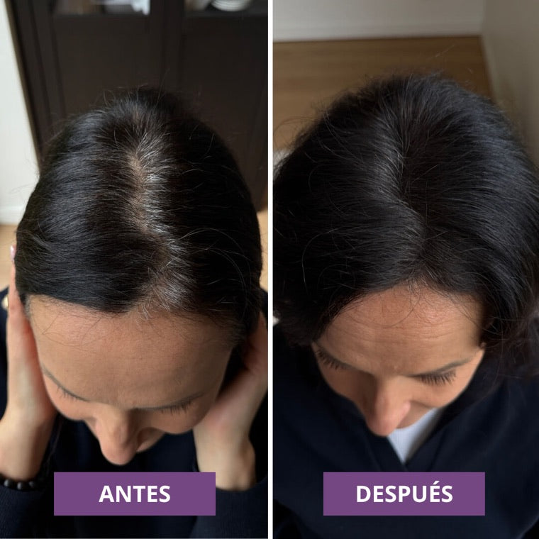 Antes y despues