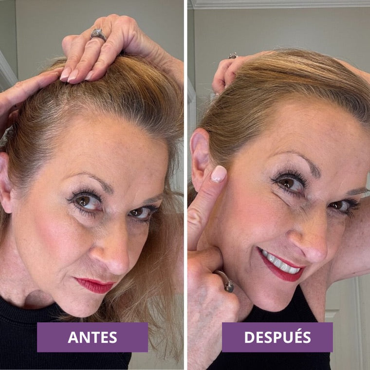 Antes y despues