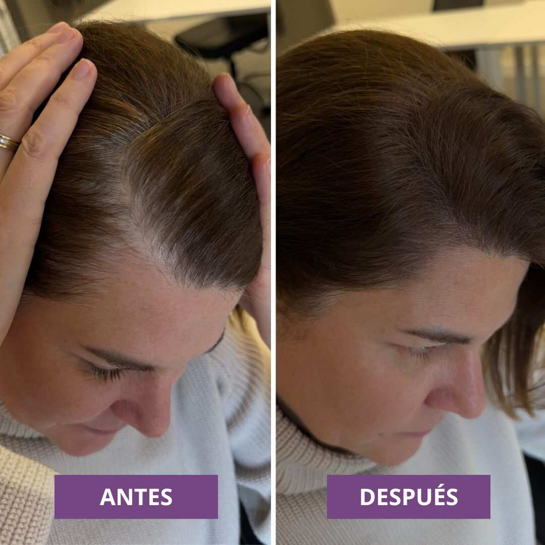 HairMagic+