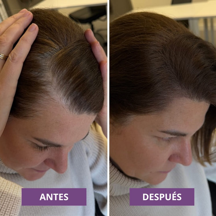 Antes y despues
