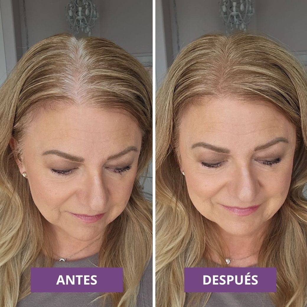 Antes y después con HairMagic+ Hairline Powder